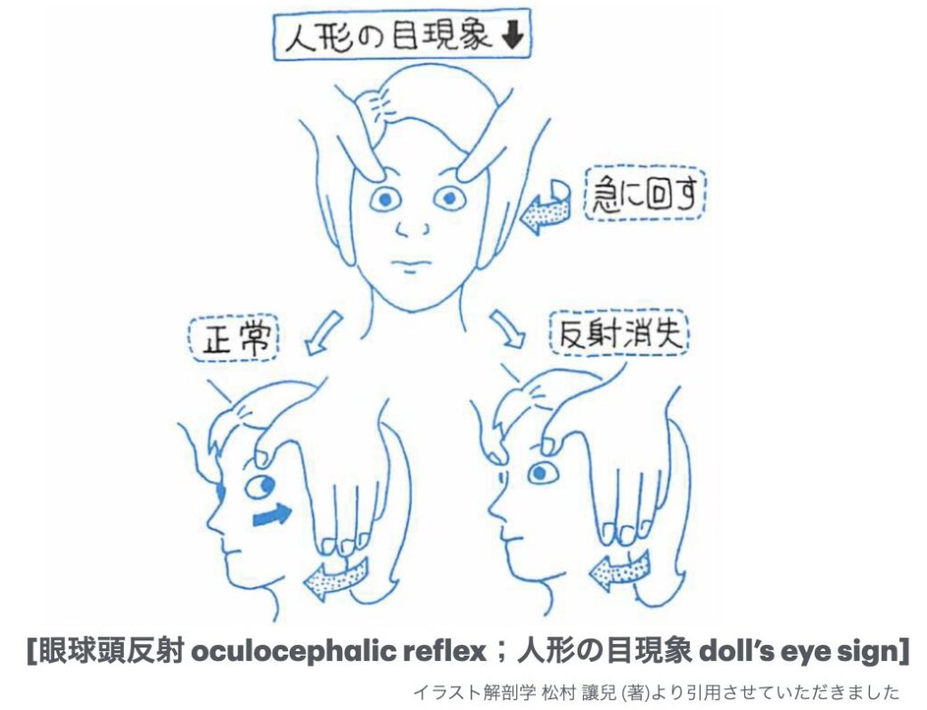 人形の眼現象