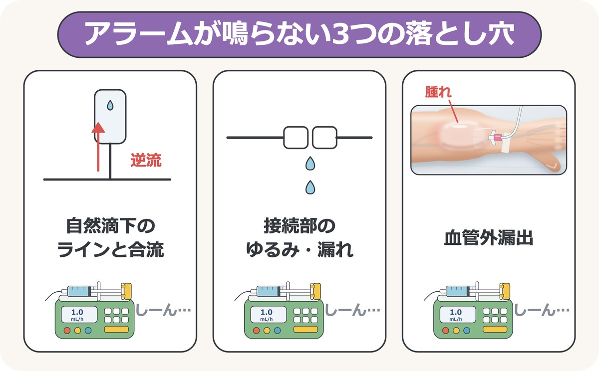 アラームが鳴らない3つの落とし穴。自然滴下のラインとの合流、接続部のゆるみや漏れ、血管外漏出